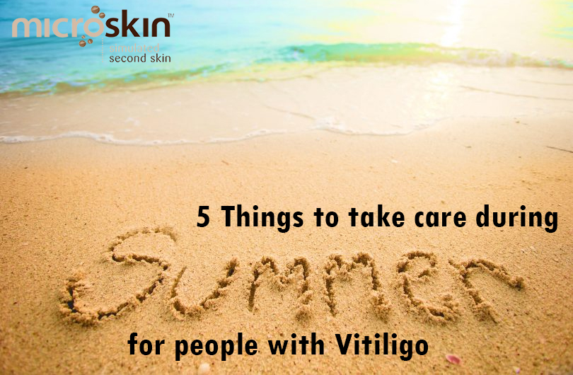 5 Things to take care during summer for people with Vitiligo